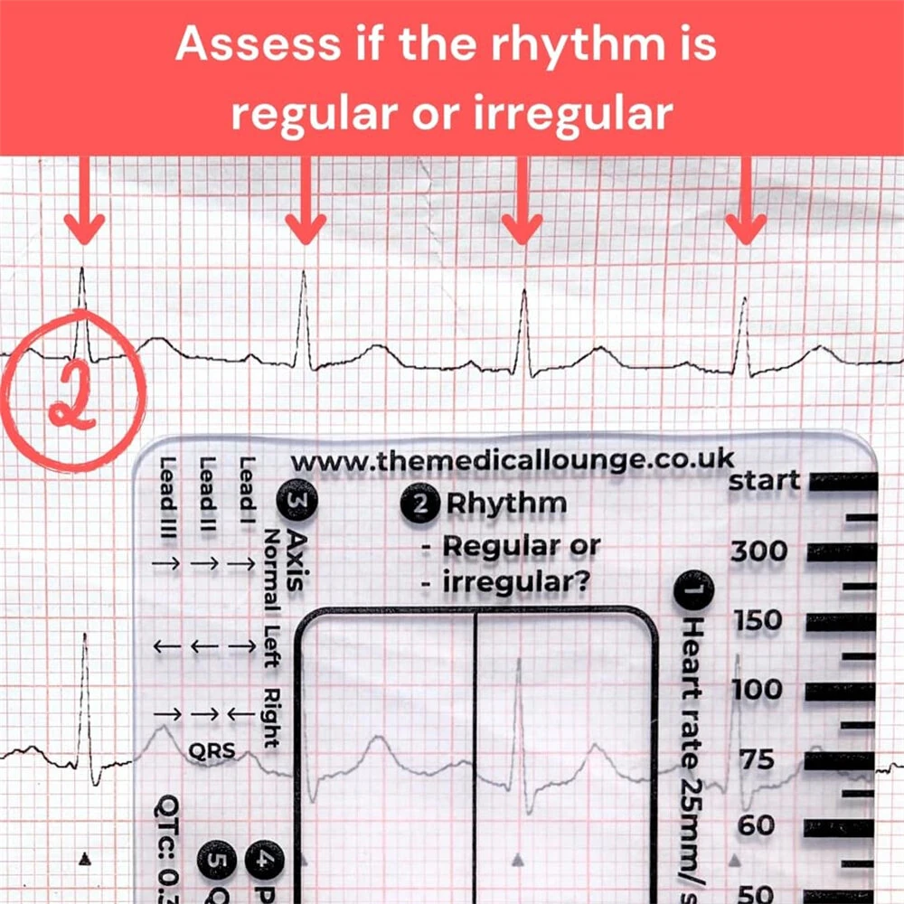 EKG Calipers 7-Step Measuring Tool - ECG Ruler Plastic Transparent & Waterproof - Image 4