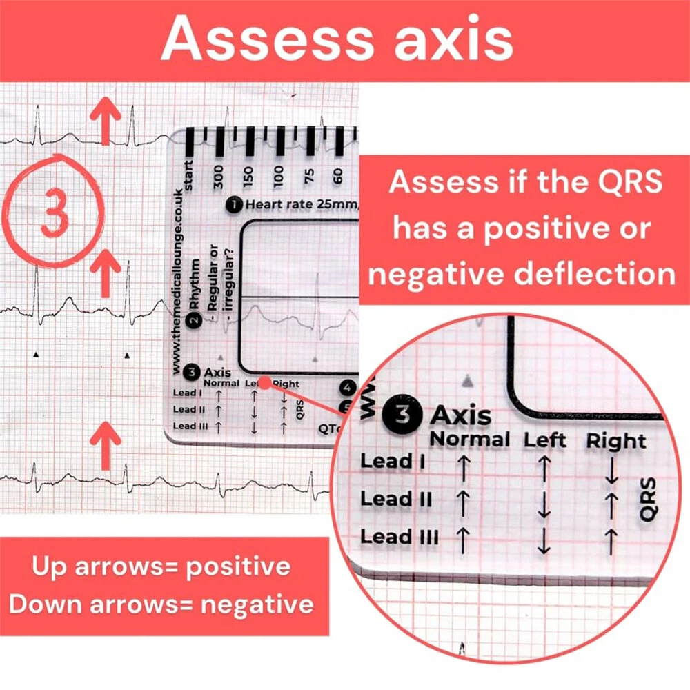 EKG Calipers 7-Step Measuring Tool - ECG Ruler Plastic Transparent & Waterproof - Image 5