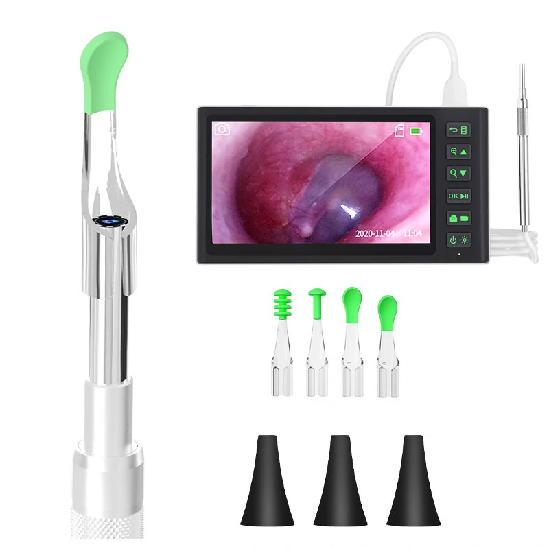 Smart Visual Ear Picker - 7.0 HD Display & 200W Camera | IP67 Waterproof, 3000mAh Battery, 3.9mm Lens - Image 2