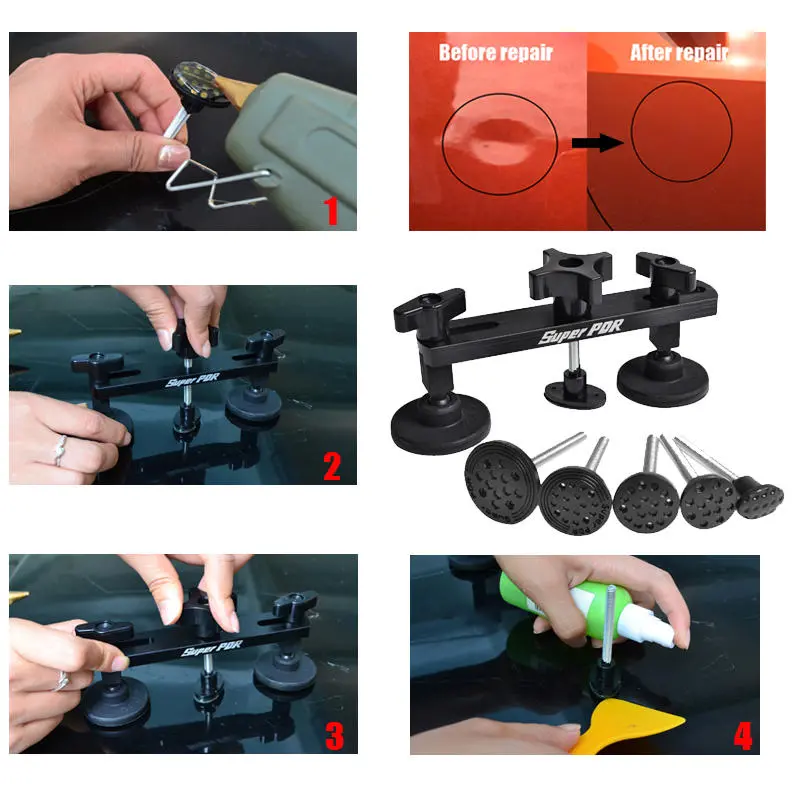 Super PDR Paintless Dent Repair Bridge Kit | Car Dent Removal Pulling Tools - Image 2