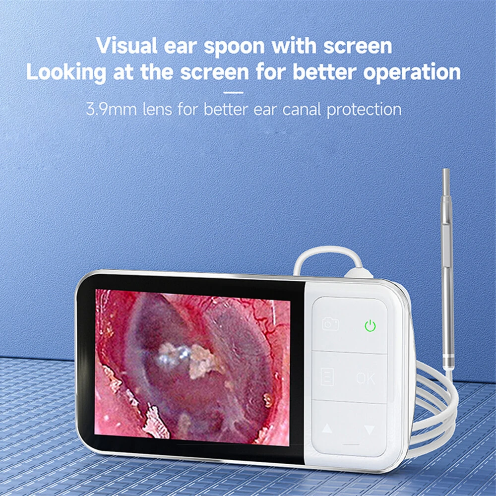 ENT Borescope | 4.5 Inch 1080P HD Screen | 3.9mm Food-Grade Silicone Ear Spoon - Image 5