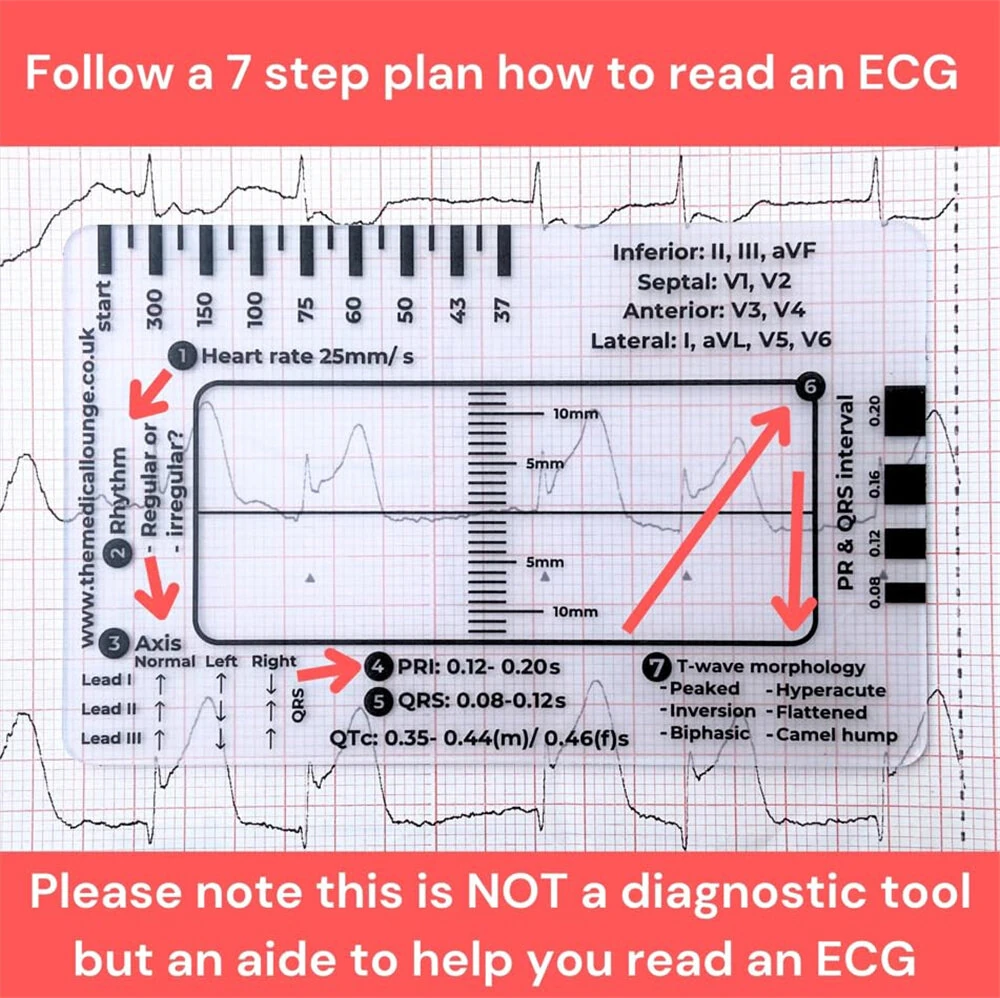 EKG Calipers 7-Step Measuring Tool - ECG Ruler Plastic Transparent & Waterproof - Image 2