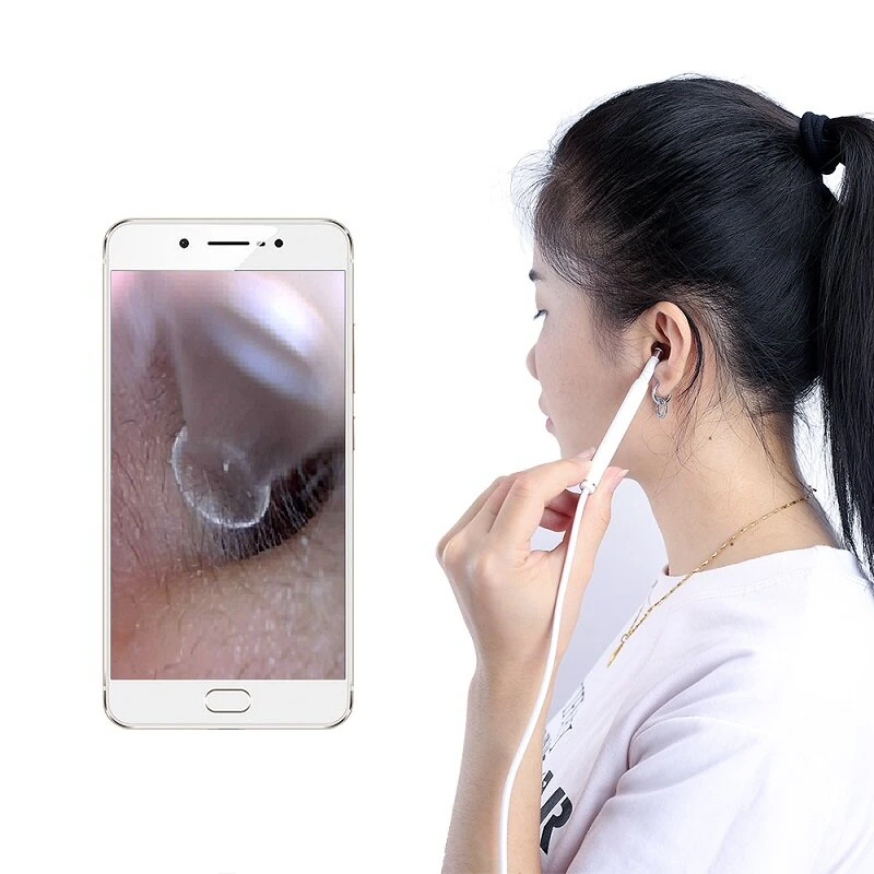 F170B White WiFi Otoscope | Wireless Ear Cleaner & USB Borescope Inspection Camera - Image 3