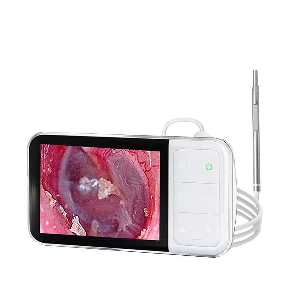ENT Borescope | 4.5 Inch 1080P HD Screen | 3.9mm Food-Grade Silicone Ear Spoon