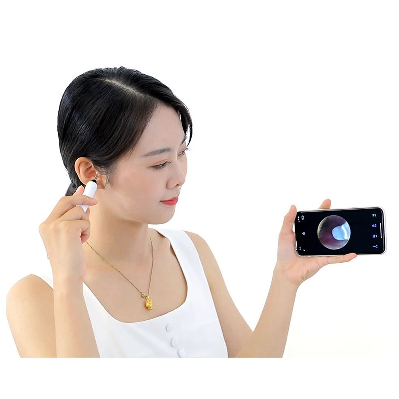 T1 WIFI 3.9mm Ear Picker Endoscope | Built-in Battery for Ear, Nose & Skin Exam