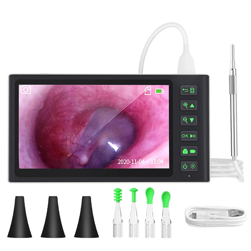 Smart Visual Ear Picker - 7.0 HD Display & 200W Camera | IP67 Waterproof, 3000mAh Battery, 3.9mm Lens